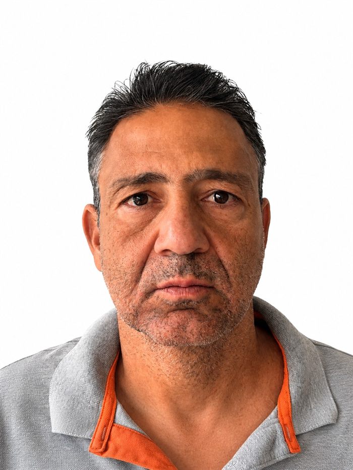 Caso 1 — registro do paciente antes do tratamento, em vista frontal.