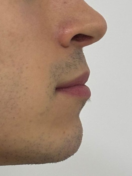 Caso 2 — perfil do paciente antes do tratamento.